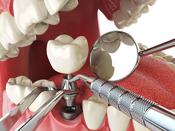 Best Same-Day Emergency Dental Services in Hasley Nyon, CA